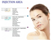 Revolax is a safe, stable and effective Hyaluronic Acid (HA) dermal filler